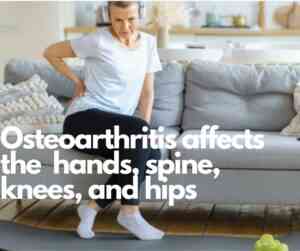 Osteoarthritis affects hands, spine, knees, and hips
