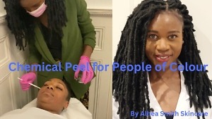 Chemical peel for people of colour